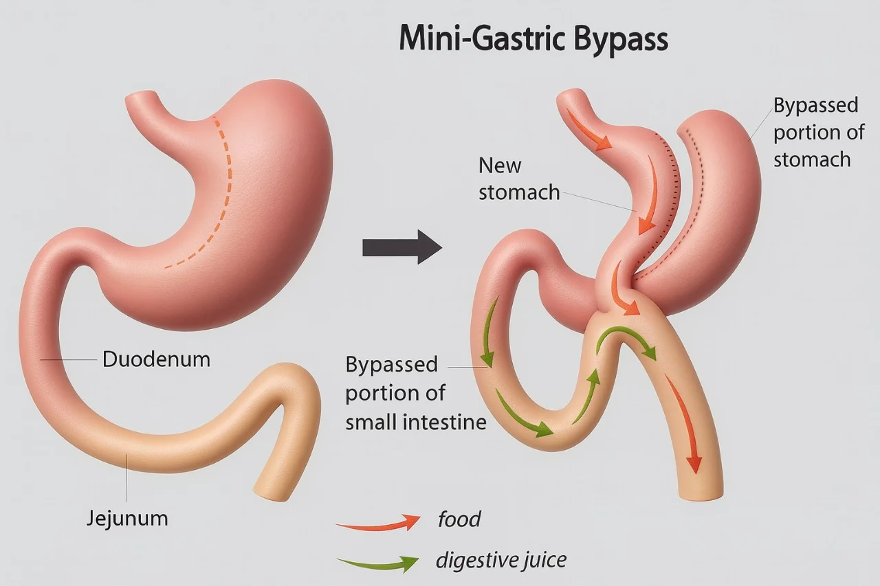تحويل المسار المصغّر — Dr. Mohamed Abdelsalam Clinic